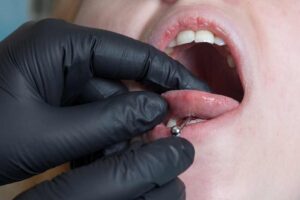 oral piercing of tongue
